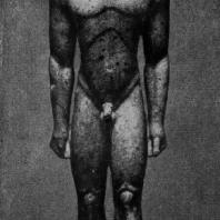 Аттический курос. Мрамор. Около 600 г. до н. э. Нью-Йорк. Метрополитен-музей
