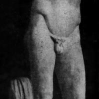 Поликлет. Диадумен. Около 420 г. до н. э. Мраморная римская копия с утраченного бронзового оригинала. Афины. Национальный музей